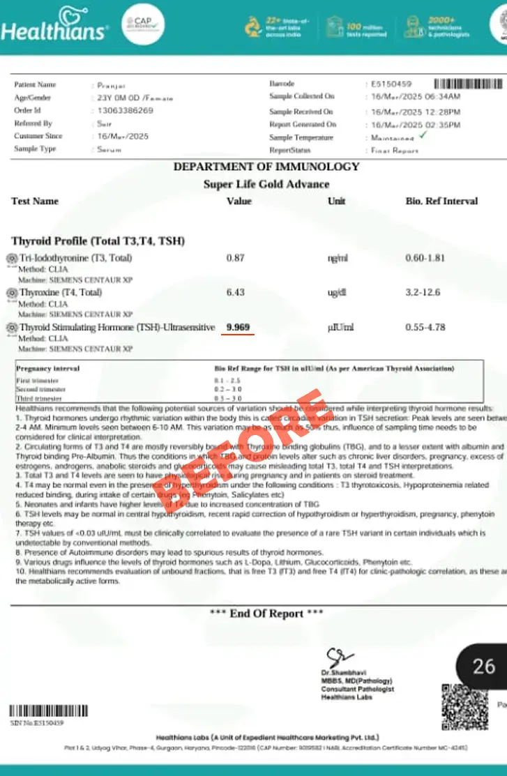 hypothyroidism report